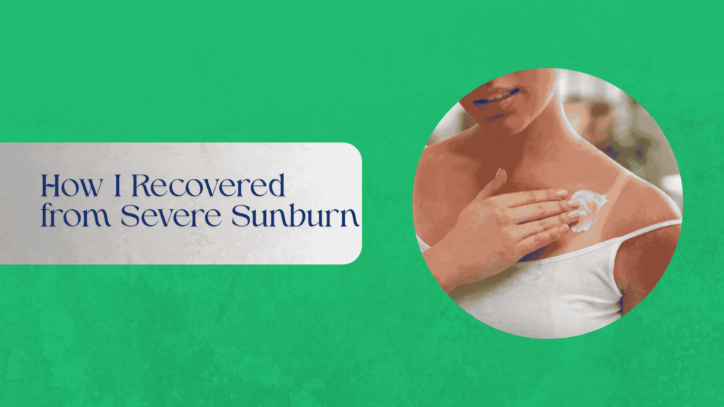 A person applying soothing lotion to their sunburned skin